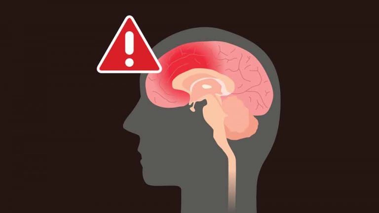 Brain still not normal 6 months after concussion
