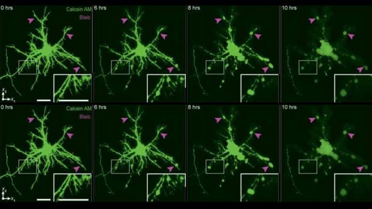 New pics of brain cells after a concussion