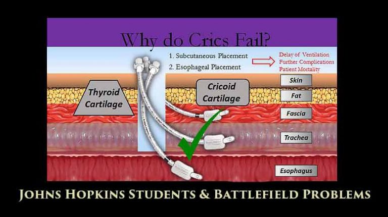 Students devise a tracheotomy device for soldiers