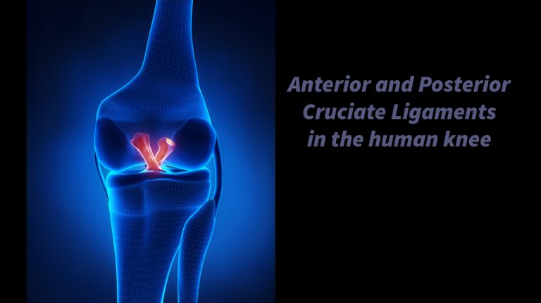 Females more likely to sustain ACL injury