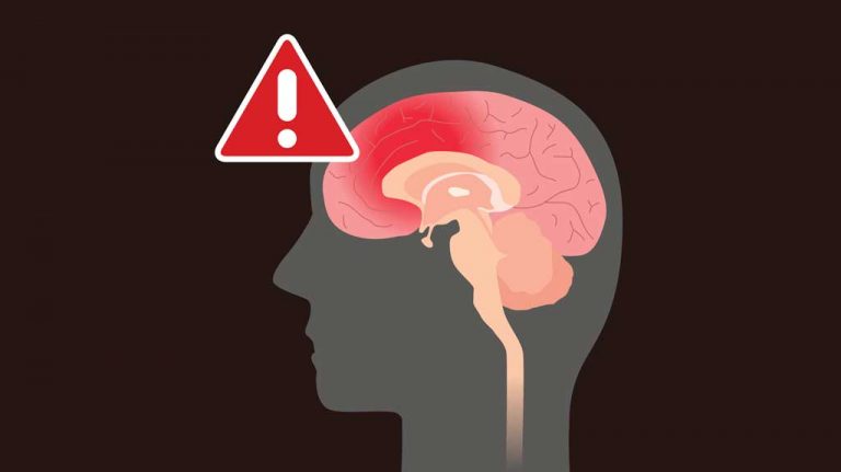 IL concussion diagnoses up over 5 years