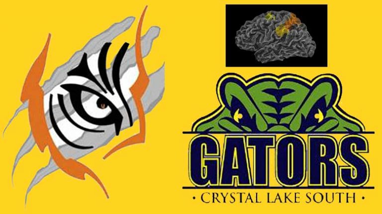 Team Up, Speak Up, Fight Concussions on Sept. 13