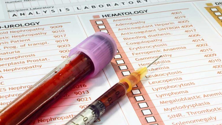 New blood test can reliably diagnose concussions