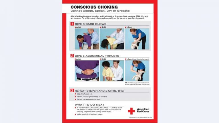Obituary: Dr. Heimlich; invented 1st aid for choking
