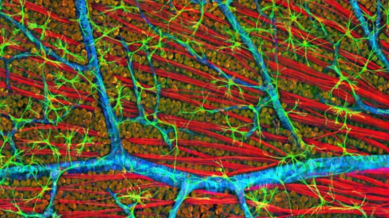Confocal micrograph of mouse retina depicting optic fiber layer. Image courtesy of National Center for Microscopy and Imaging Research, UC San Diego.