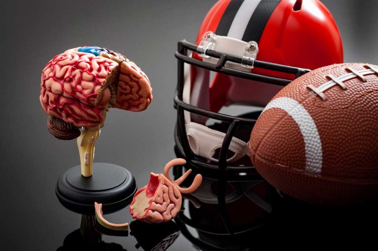 Concussion recovery longer in brain than clinically