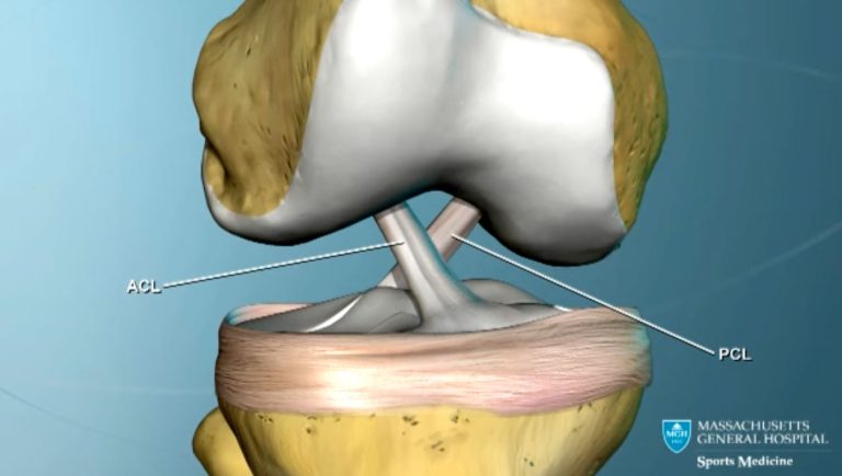 Inside the gender gap in ACL injuries in sports