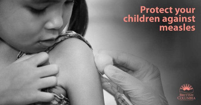 measles-bc-canada